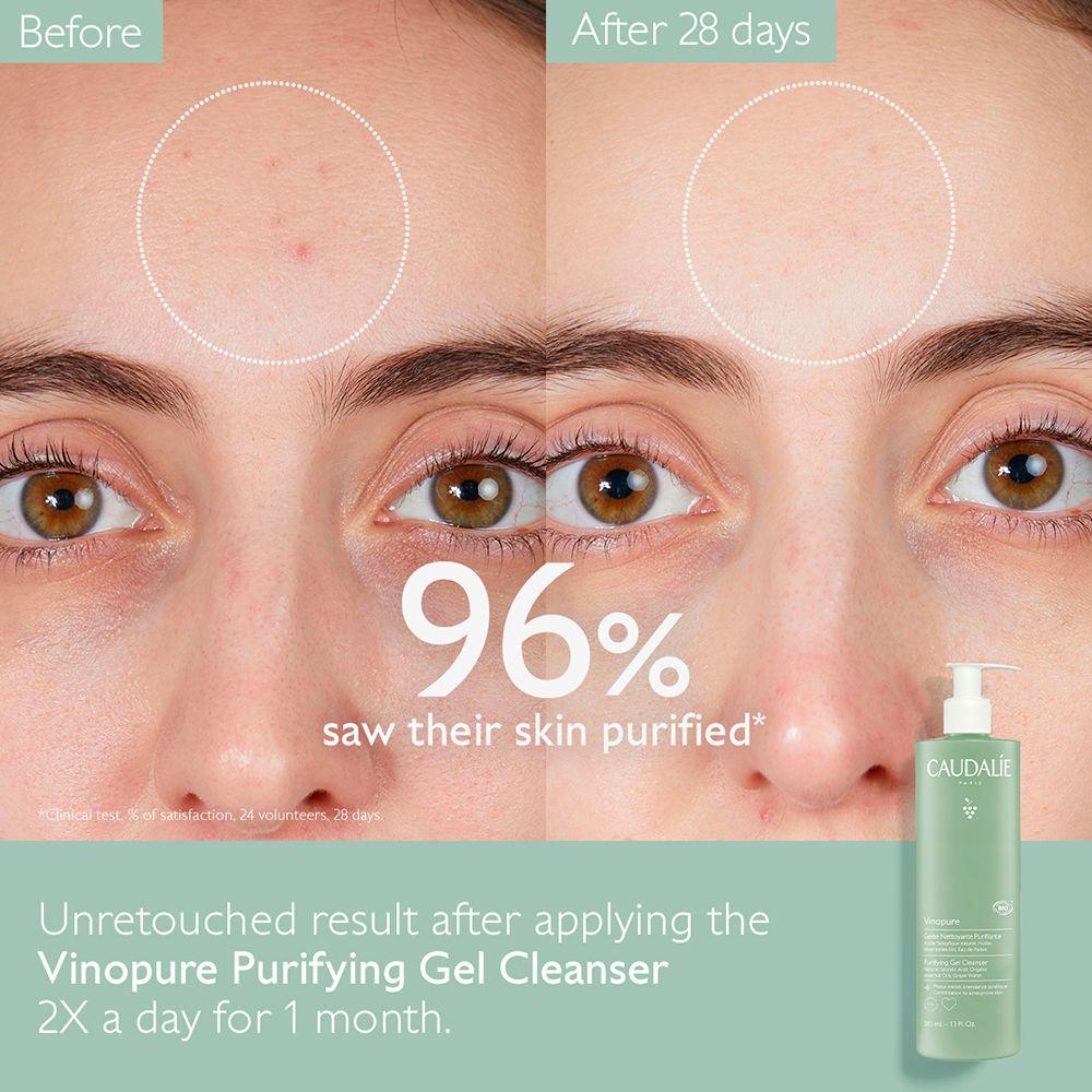 Caudalie VINOPURE Gelatina detergente purificante ACQUISTA ORA